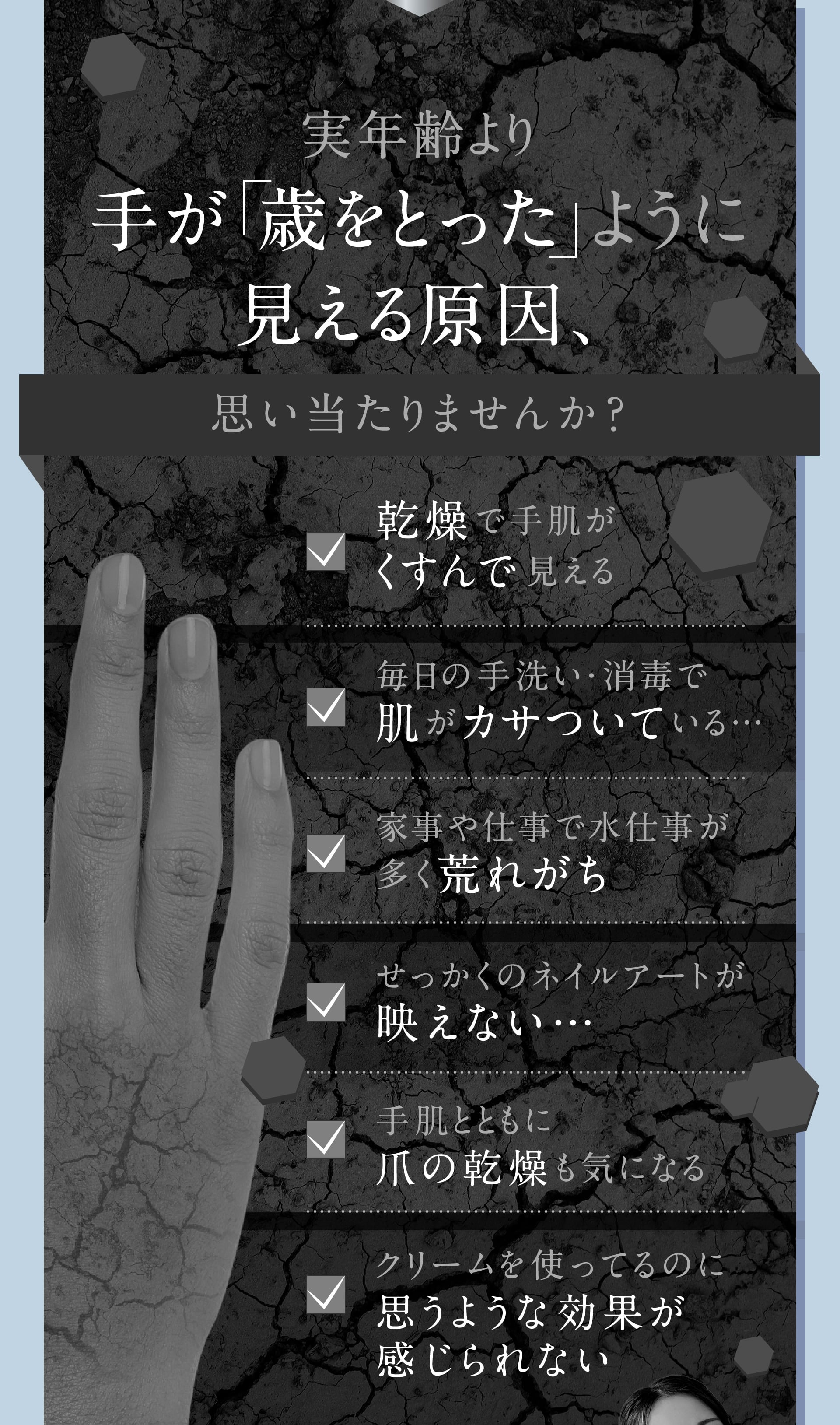 手が「歳をとった」ように見える原因に思い当たりませんか？