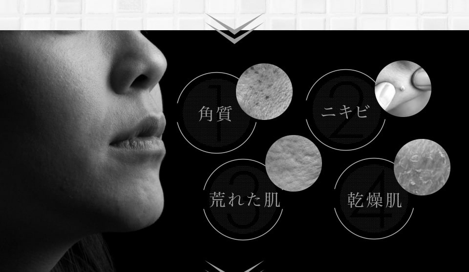 角質、ニキビ、荒れた肌、乾燥肌