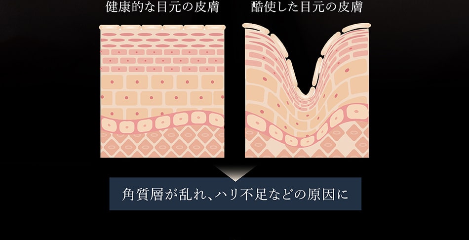 角質層が乱れ、ハリ不足などの原因に